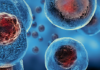 Types of diseases treated by stem cells