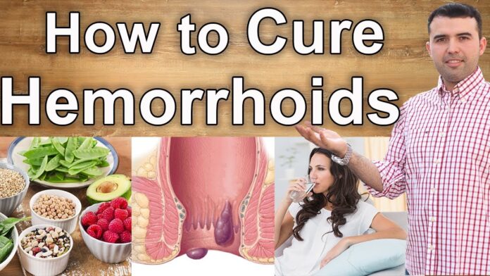 how to cure hemorrhoids